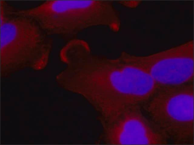 Monoclonal Anti-EXOC6 antibody produced in mouse