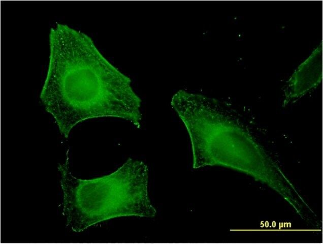 Monoclonal Anti-FEM1B antibody produced in mouse