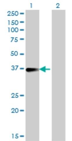 Monoclonal Anti-FCER2 antibody produced in mouse