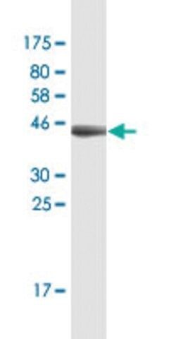 Monoclonal Anti-FDX1, (C-terminal) antibody produced in mouse