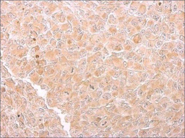 Monoclonal Anti-Citrate synthetase antibody produced in mouse