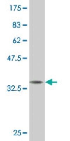 Monoclonal Anti-CITED1 antibody produced in mouse