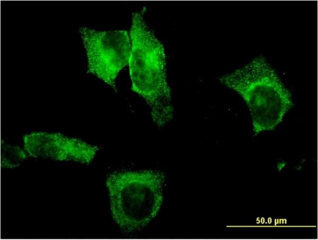 Monoclonal Anti-CEL antibody produced in mouse