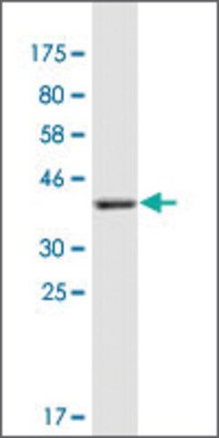 Monoclonal Anti-COL21A1 antibody produced in mouse