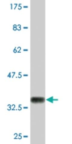 Monoclonal Anti-COL23A1 antibody produced in mouse