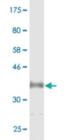 Monoclonal Anti-CYP46A1 antibody produced in mouse