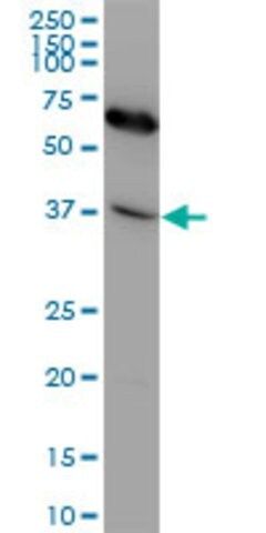 Monoclonal Anti-CXCR4, (N-terminal) antibody produced in mouse