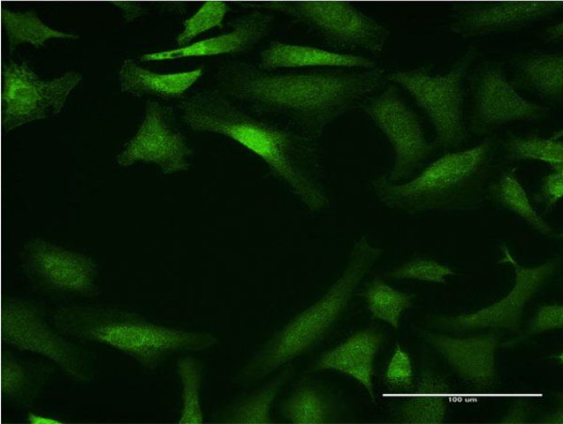 Monoclonal Anti-CYP26B1 antibody produced in mouse