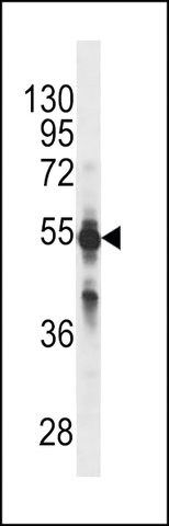 MONOCLONAL ANTI-CYP2C9 (N-TERMINAL) antibody produced in mouse