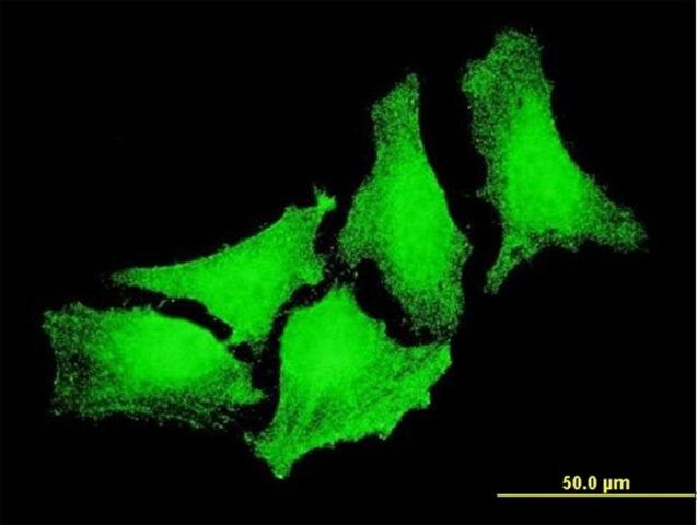 Monoclonal Anti-CYGB antibody produced in mouse