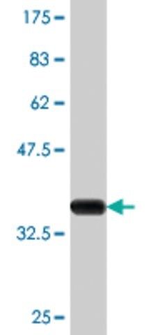 Monoclonal Anti-CYP24A1, (C-terminal) antibody produced in mouse