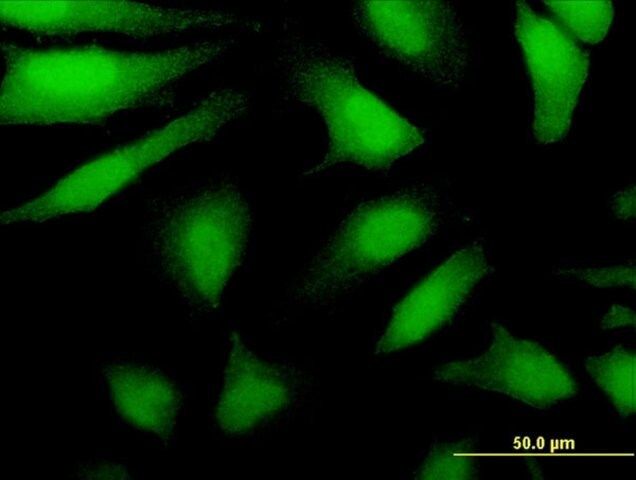 Monoclonal Anti-DDX43 antibody produced in mouse