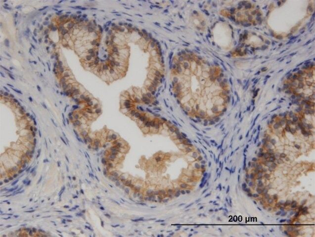 Monoclonal Anti-CYP7B1 antibody produced in mouse