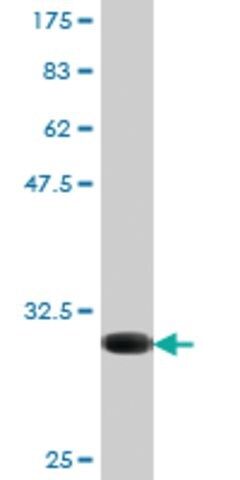 Monoclonal Anti-CX3CR1, (N-terminal) antibody produced in mouse