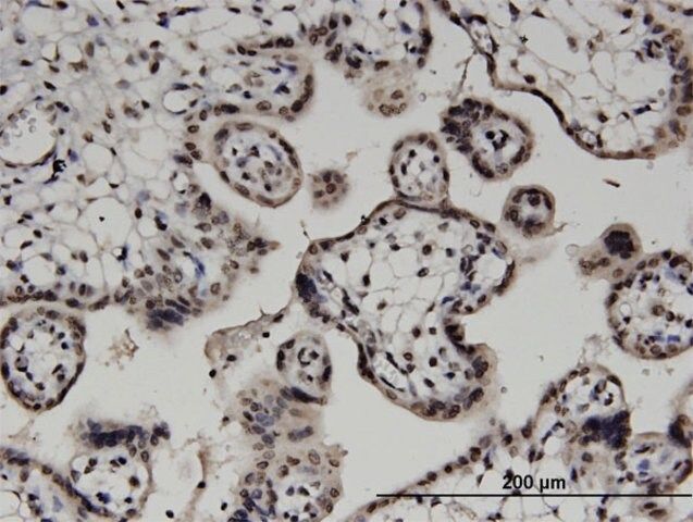 Monoclonal Anti-DGKA antibody produced in mouse