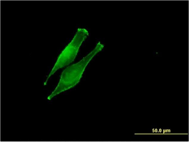 Monoclonal Anti-DDOST antibody produced in mouse