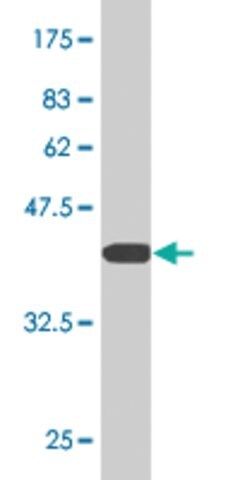 Monoclonal Anti-DDX1, (C-terminal) antibody produced in mouse