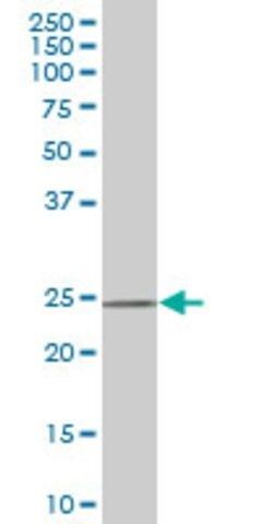 Monoclonal Anti-DCUN1D1, (N-terminal) antibody produced in mouse