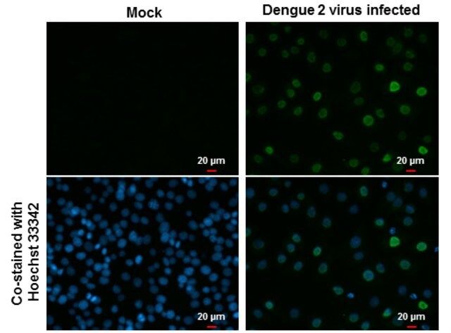 Monoclonal Anti-Dengue virus Type 2 NS5 protein antibody produced in mouse