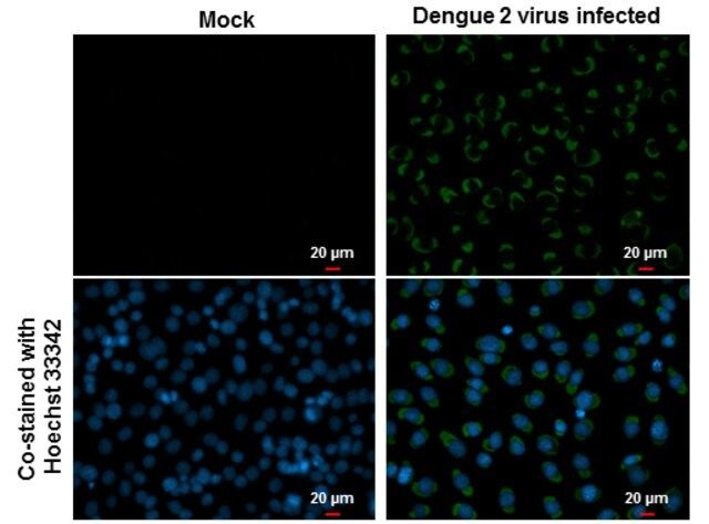 Monoclonal Anti-Dengue virus Envelope protein antibody produced in mouse