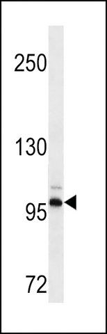 MONOCLONAL ANTI-DDR2 antibody produced in mouse