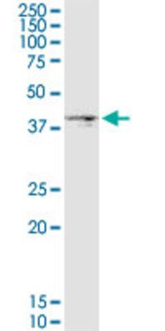 Monoclonal Anti-DGAT2, (C-terminal) antibody produced in mouse