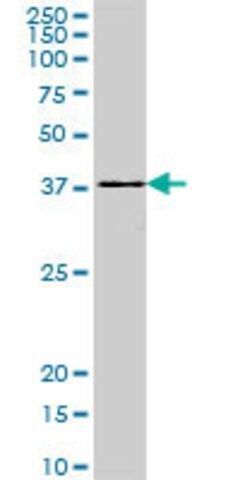 Monoclonal Anti-DEGS1, (C-terminal) antibody produced in mouse