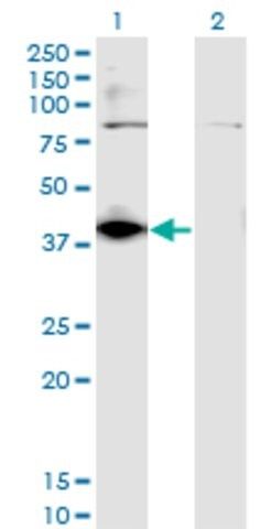 Monoclonal Anti-DHDH, (C-terminal) antibody produced in mouse