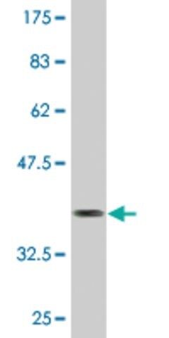 Monoclonal Anti-DES, (C-terminal) antibody produced in mouse