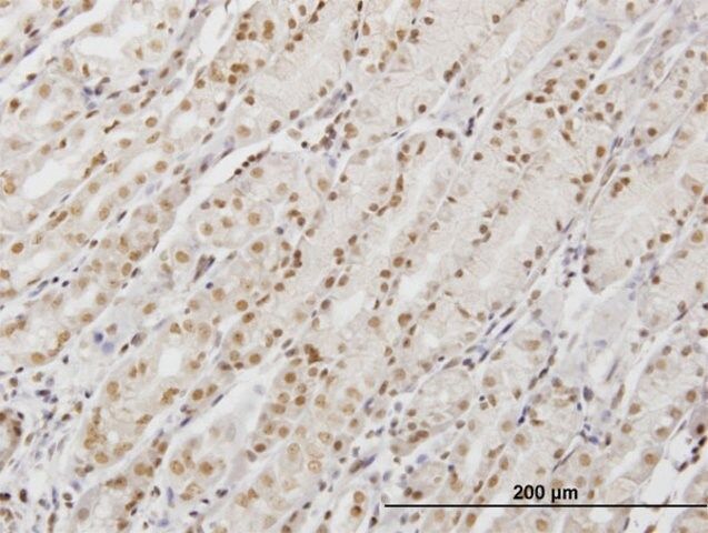 Monoclonal Anti-DDX54, (C-terminal) antibody produced in mouse