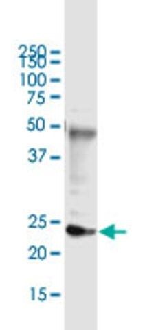 Monoclonal Anti-DDIT4L, (C-terminal) antibody produced in mouse