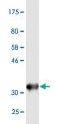 Monoclonal Anti-DHX9, (N-terminal) antibody produced in mouse