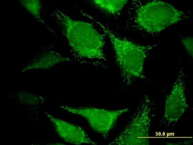 Monoclonal Anti-DECR2 antibody produced in mouse