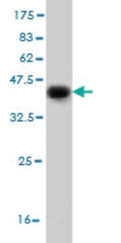 Monoclonal Anti-DFNB31 antibody produced in mouse