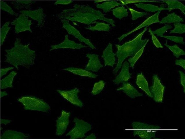 Monoclonal Anti-DFNB31 antibody produced in mouse