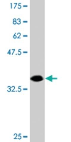 Monoclonal Anti-DIP2A antibody produced in mouse