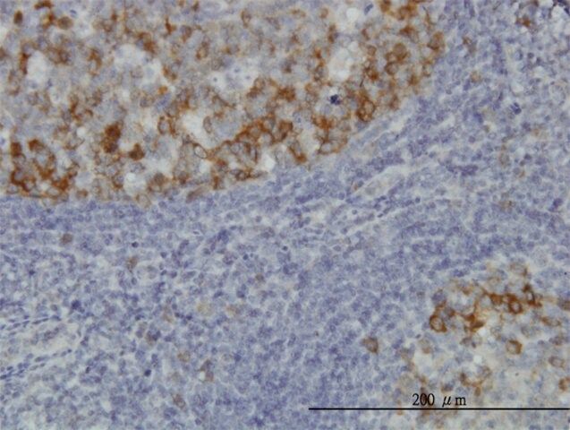 Monoclonal Anti-BUB1B antibody produced in mouse