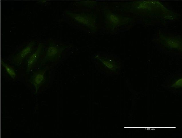 Monoclonal Anti-BTBD9 antibody produced in mouse