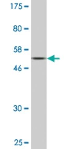 Monoclonal Anti-BST1 antibody produced in mouse