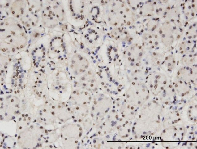 Monoclonal Anti-CBFA2T2 antibody produced in mouse