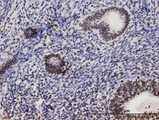 Monoclonal Anti-CCDC131 antibody produced in mouse