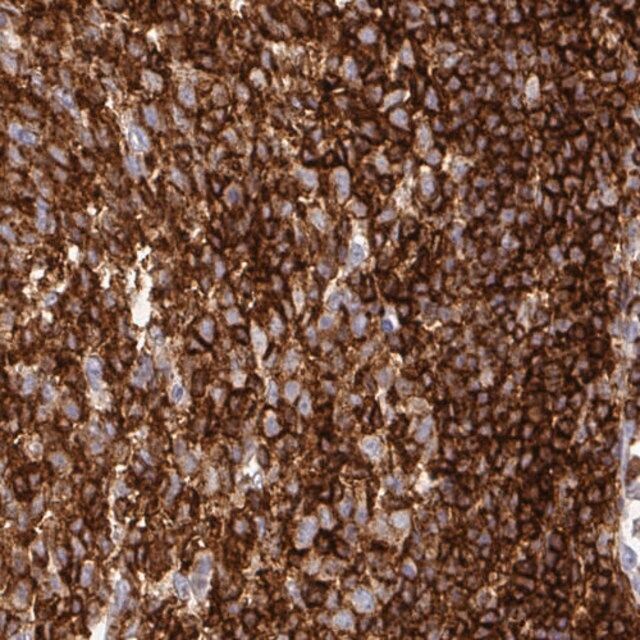 Monoclonal Anti-CD45 antibody produced in mouse