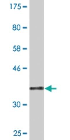 Monoclonal Anti-CDY2A antibody produced in mouse