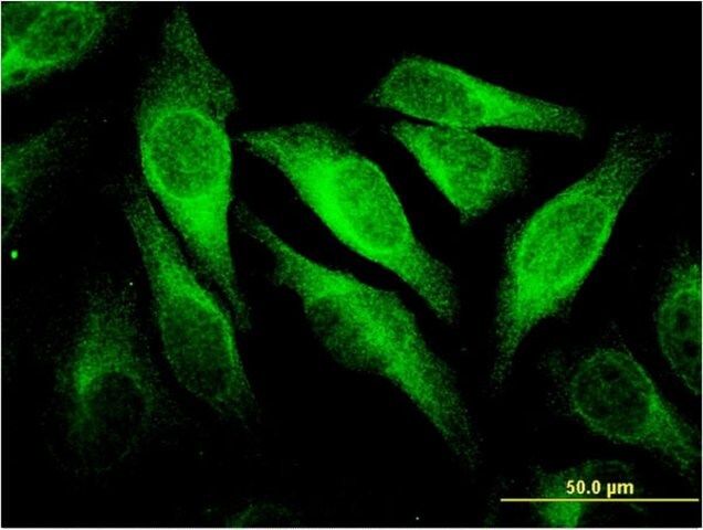 Monoclonal Anti-CEACAM6 antibody produced in mouse