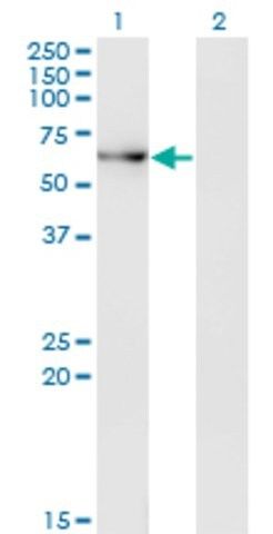 Monoclonal Anti-ACD antibody produced in mouse