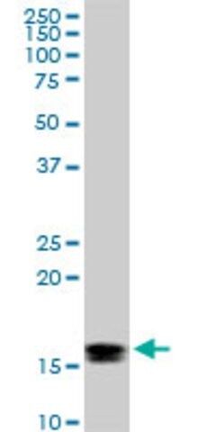 Monoclonal Anti-ACP1 antibody produced in mouse