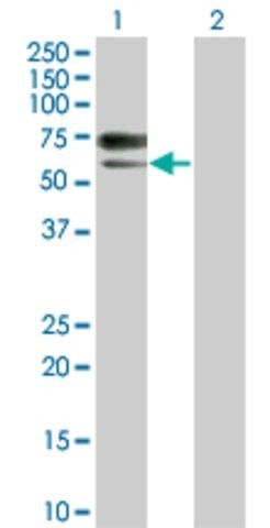 Monoclonal Anti-ACVRL1 antibody produced in mouse