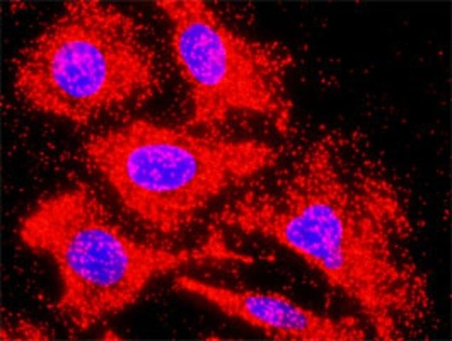 Monoclonal Anti-ACVR1C antibody produced in mouse