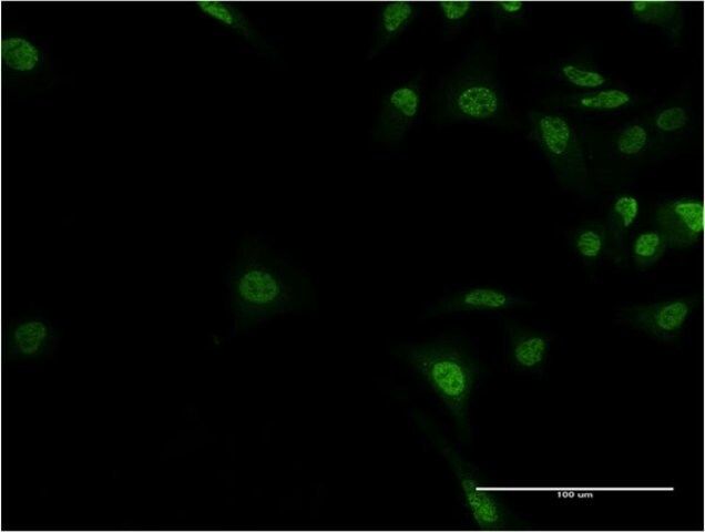 Monoclonal Anti-ADNP, (C-terminal) antibody produced in mouse