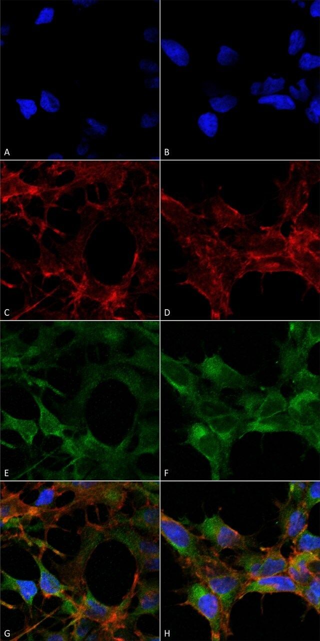 Monoclonal Anti-Acrolein antibody produced in mouse